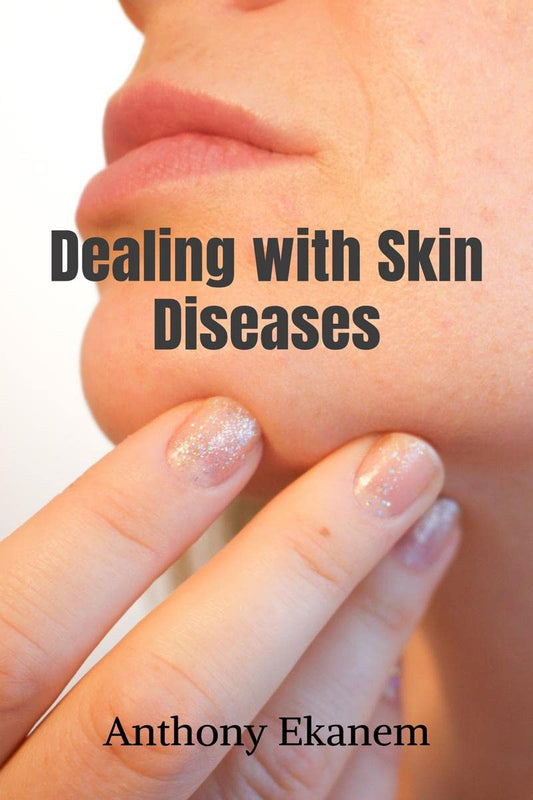Dealing with Skin Diseases Paperback